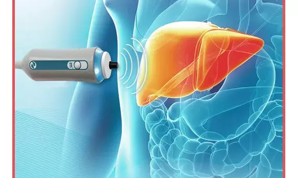 निशुल्क स्वास्थ्य शिविर का आयोजन 15 को निशुल्क स्वास्थ्य शिविर का आयोजन 15 को