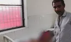 गैस किल्लत ने ली मासूमों की मुस्कान; चूल्हे पर खाना बनाते समय फटा कुकर, एक ही परिवार के 4 झुलसे