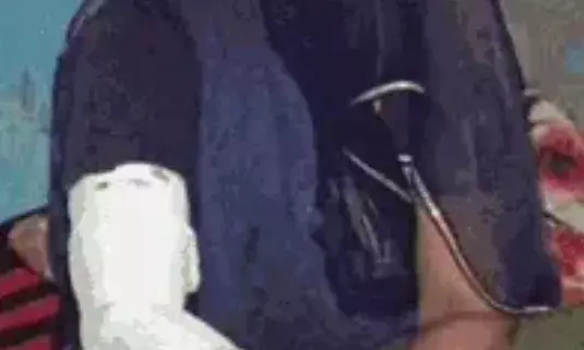 साहस की मिसाल: गंगापुर में लेपर्ड के हमले से भिड़ी महिला, दांतली से वार कर बचाई जान