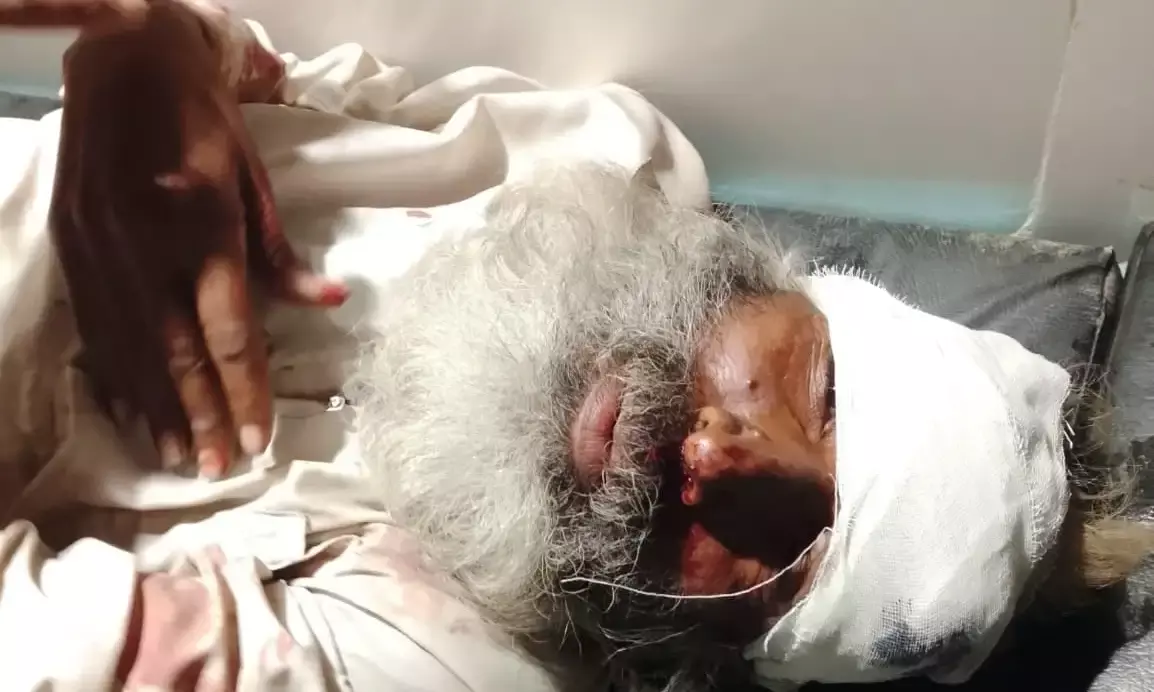 सड़क किनारे पड़ा मिला घायल अधेड़, पुलिस कर रही पहचान का प्रयास