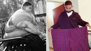 बिना किसी सर्जरी और दवा के 294 किलो के शख्स ने ऐसे घटाया 165 किलो वजन, सिर्फ रूटीन में बदली ये आदतें