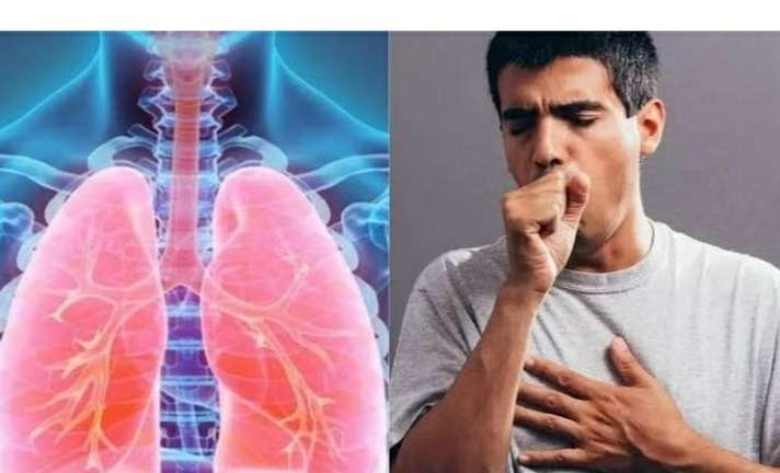 ठंड में प्रदूषण ने बढ़ा दी फेफड़ों की समस्या, सामान्य लोगों का भी फूल रहा दम, इन बातों का रखें ध्यान